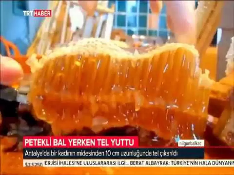 kapali-tiroid-ameliayti-nedir