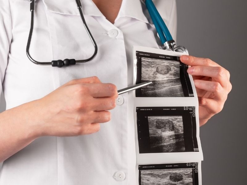 paratiroid-adenomu-nedir